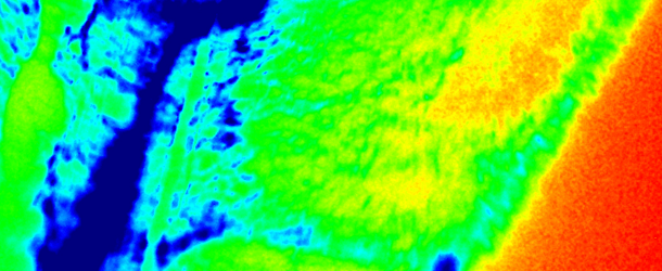 New Use of Infrared Light Can Spot Cancer Instantly