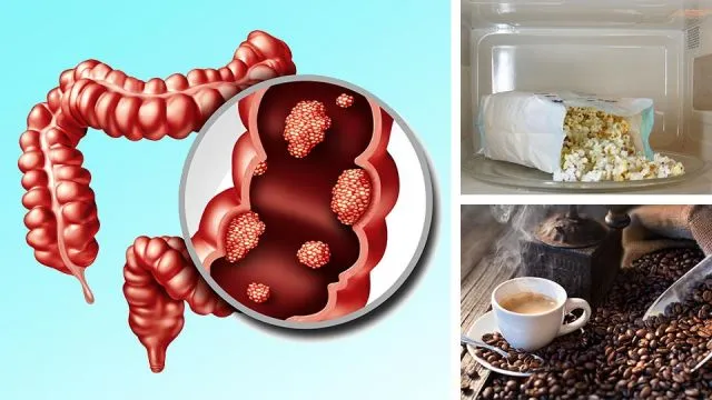 coloncancerfoodsthatincreaseriskfight_featured_960x540