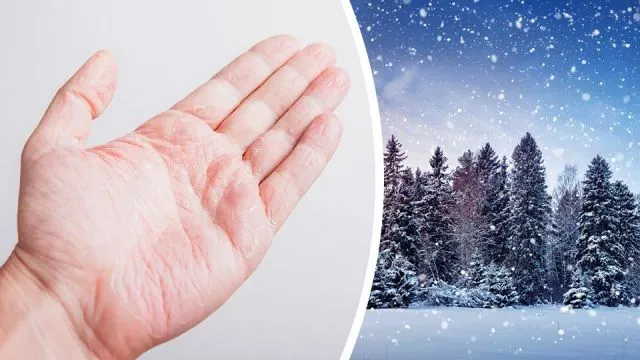 ifyouhavedryhandsduringwinter_featured_960x540