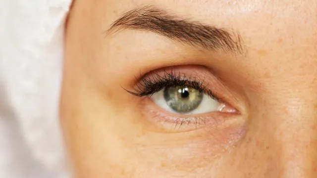 wrinkles under the eyes